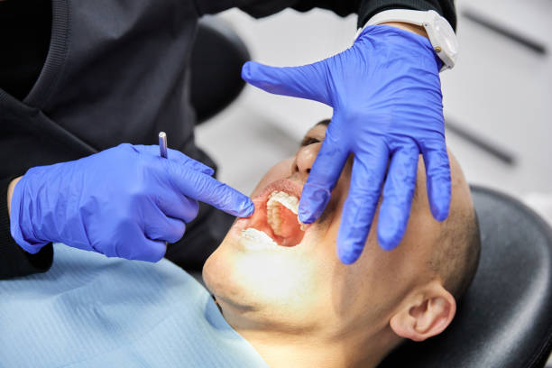 Best Emergency Dentist for Knocked-Out Tooth in Baden, PA